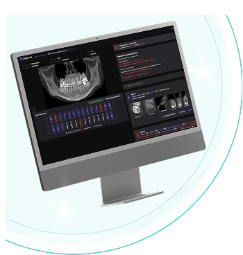 Запишитесь сейчас — и получите диагностику премиум-уровня бесплатно