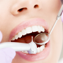 Имплантация зубной эмали