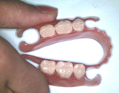 Мягкие протезы зубов