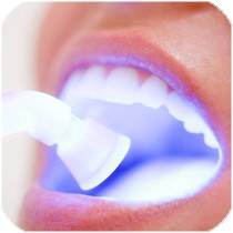 простое фторирование зубов